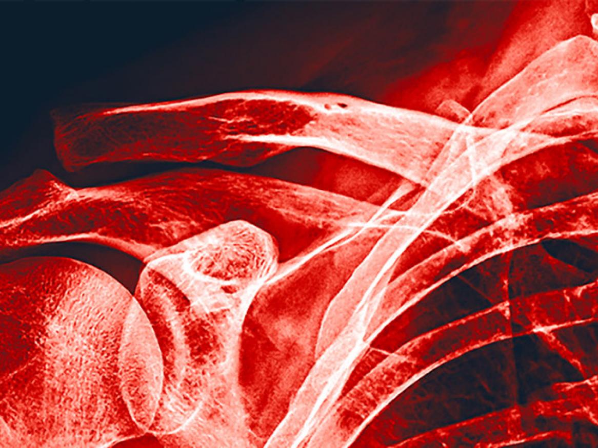 Revolutionising radiation protection